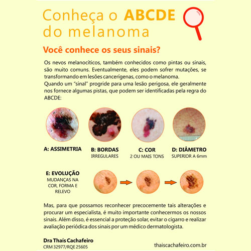 ABCDE