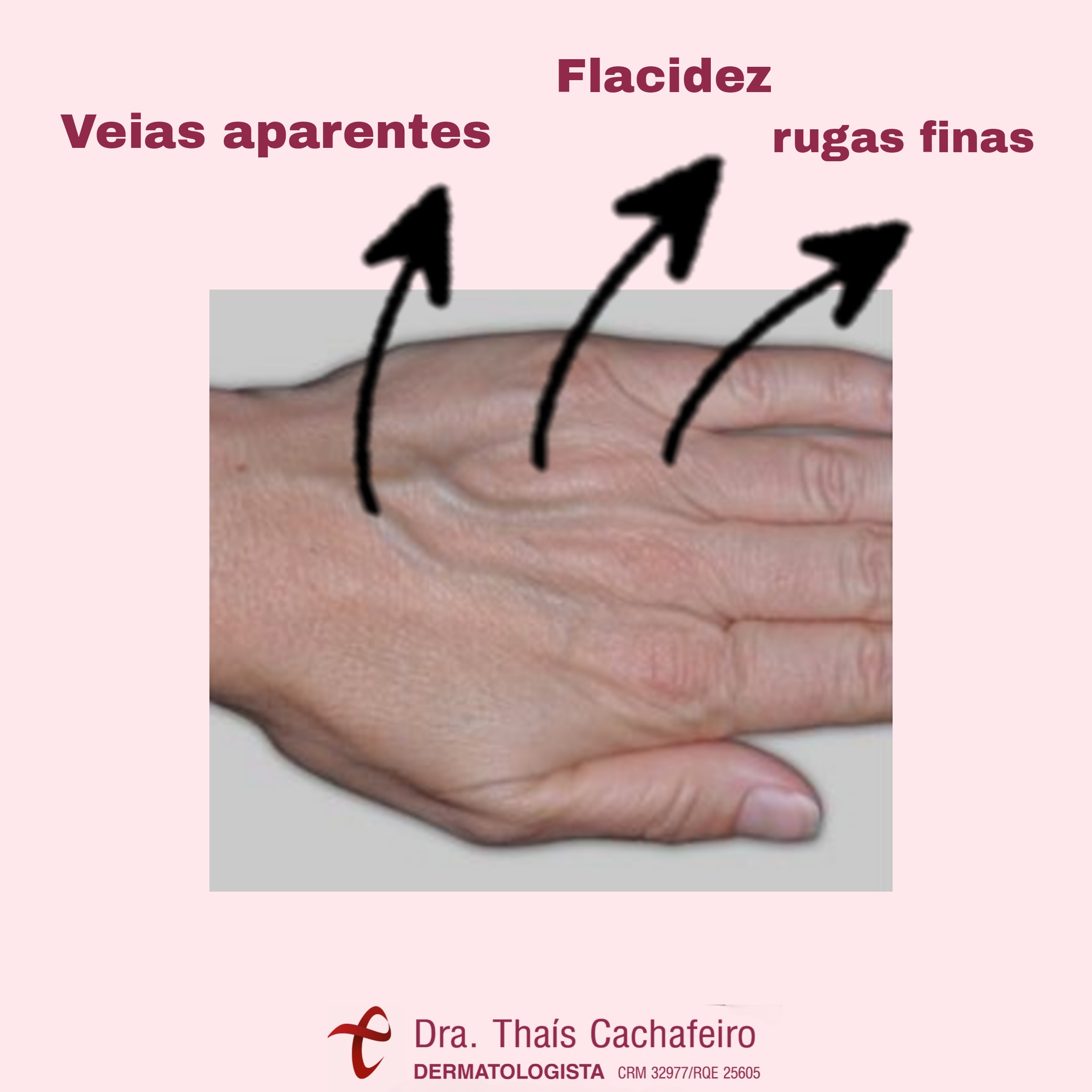Tratamento das mãos